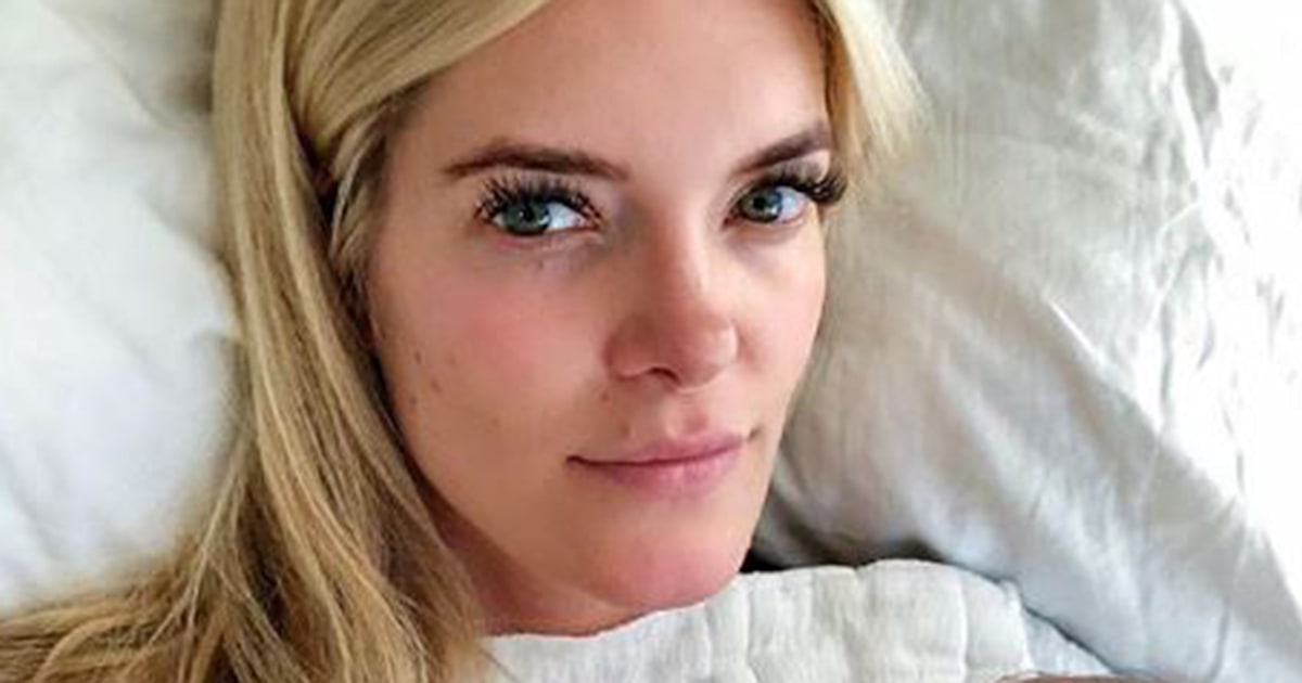 'Summer House' star Ashley Wirkus opens up about skin cancer diagnosis