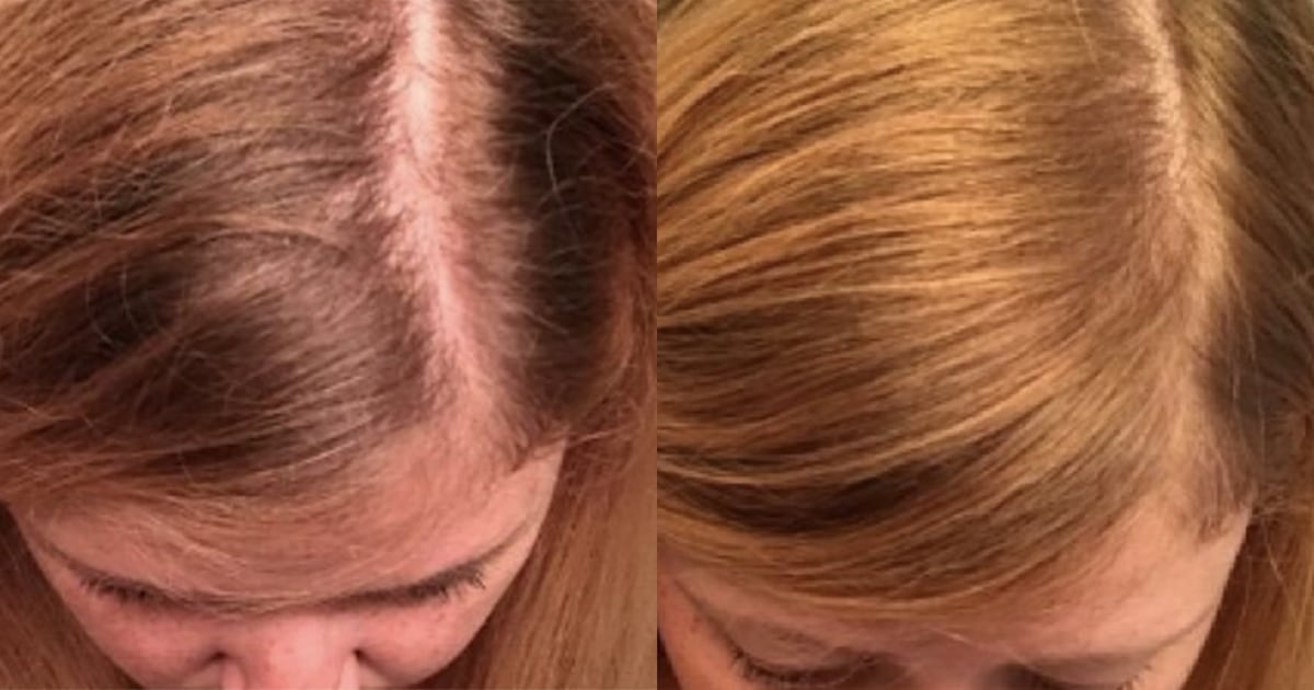 People are loving affordable hair-lightening spray