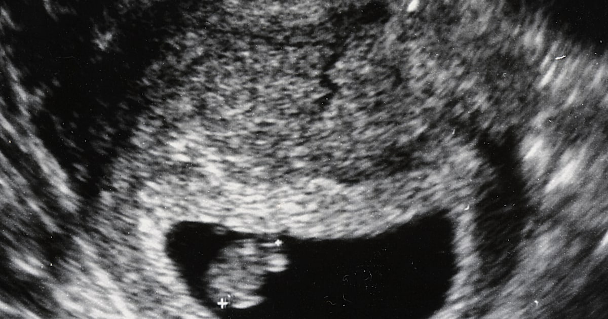 Малыш на 11 неделе. 11 И 5 недель беременности УЗИ. Плод на 6 неделе беременности УЗИ. Эмбрион на 6 неделе беременности УЗИ. Эмбрион на 11 неделе беременности.