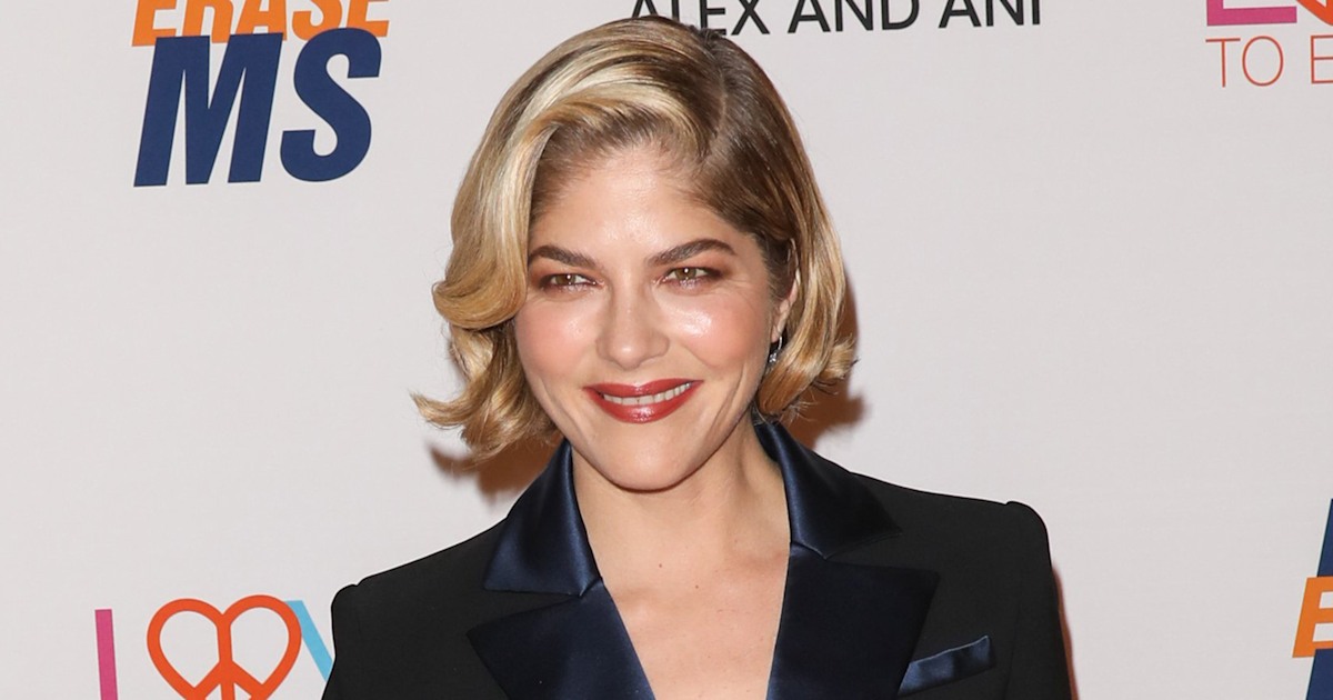 Selma Blair shares photo of 'peach fuzz' on her face from MS treatment