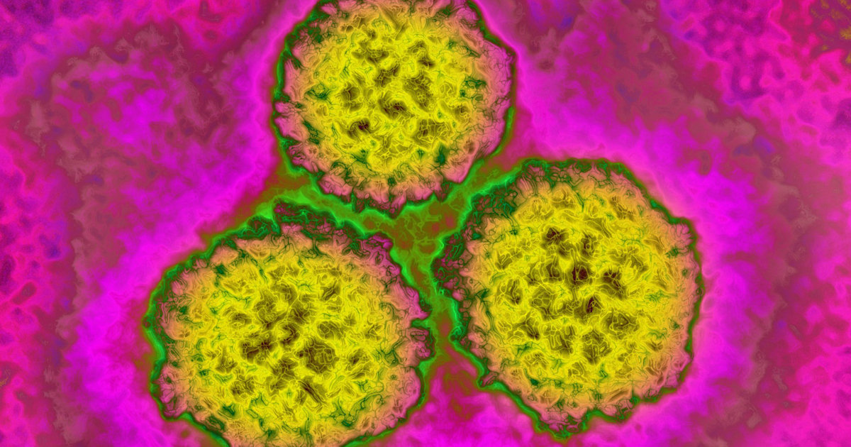 Can you get rid of HPV once you have it? What to know if a Pap test detects virus