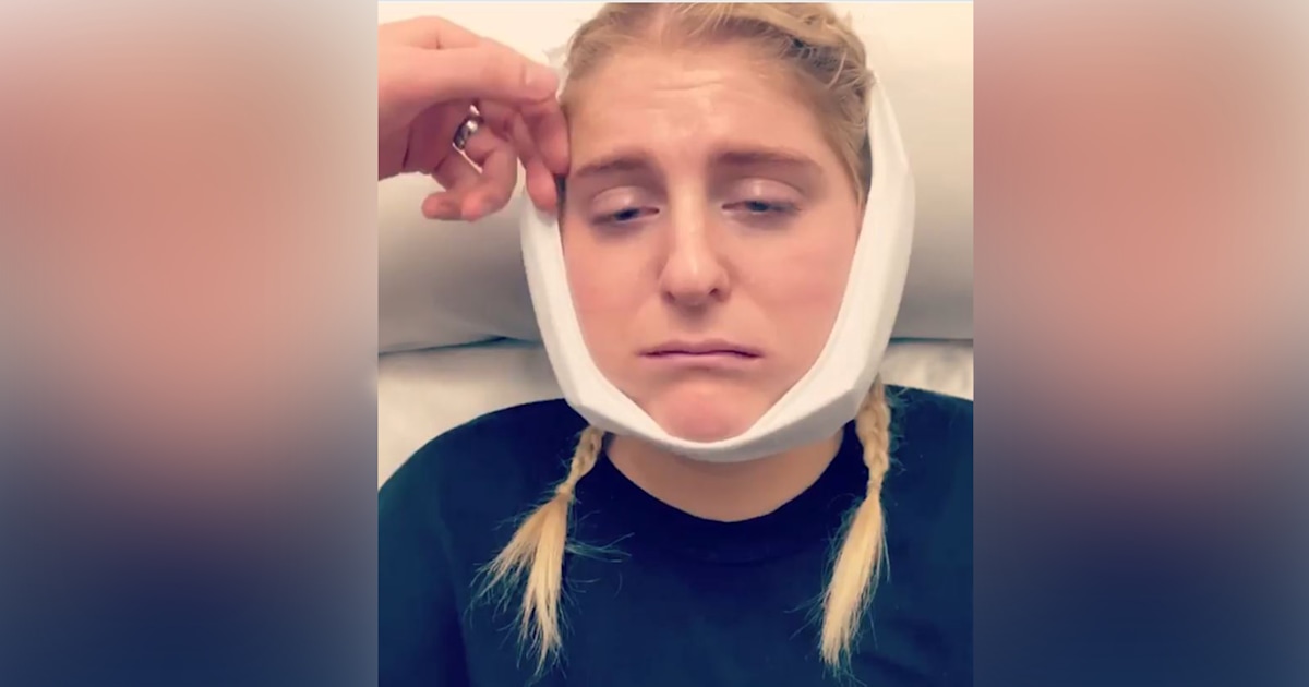 Meghan Trainor shares hilarious videos of herself after getting wisdom