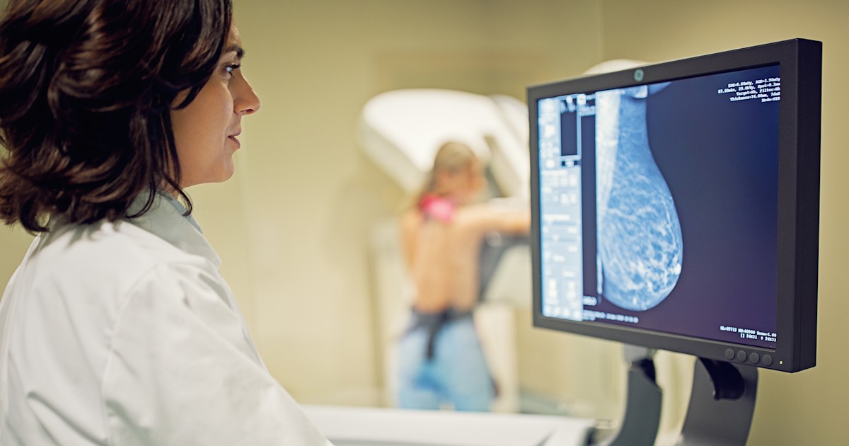 I panicked after I was called back for a mammogram — here's why you shouldn't