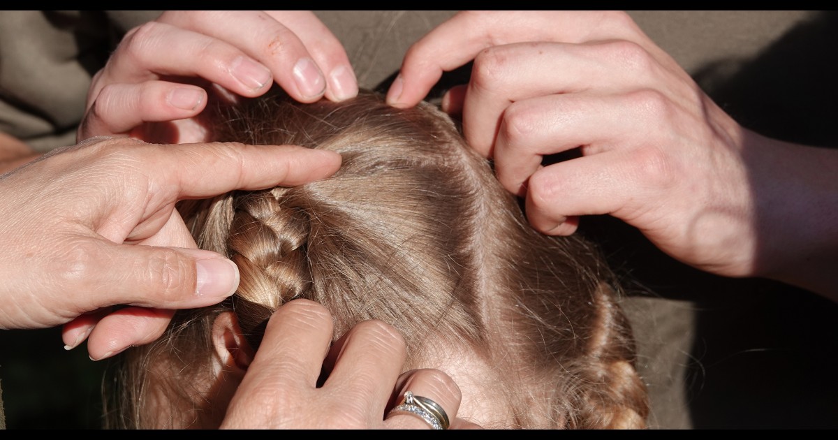 Lice Treatment New Drug Approved To Get Rid Of Lice Lice Eggs Lice Treatment New Drug Approved To Get Rid Of Lice Lice Eggs