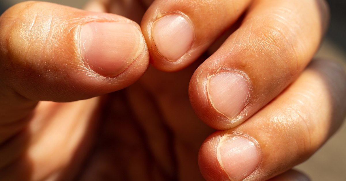 What your nails can tell you about your health