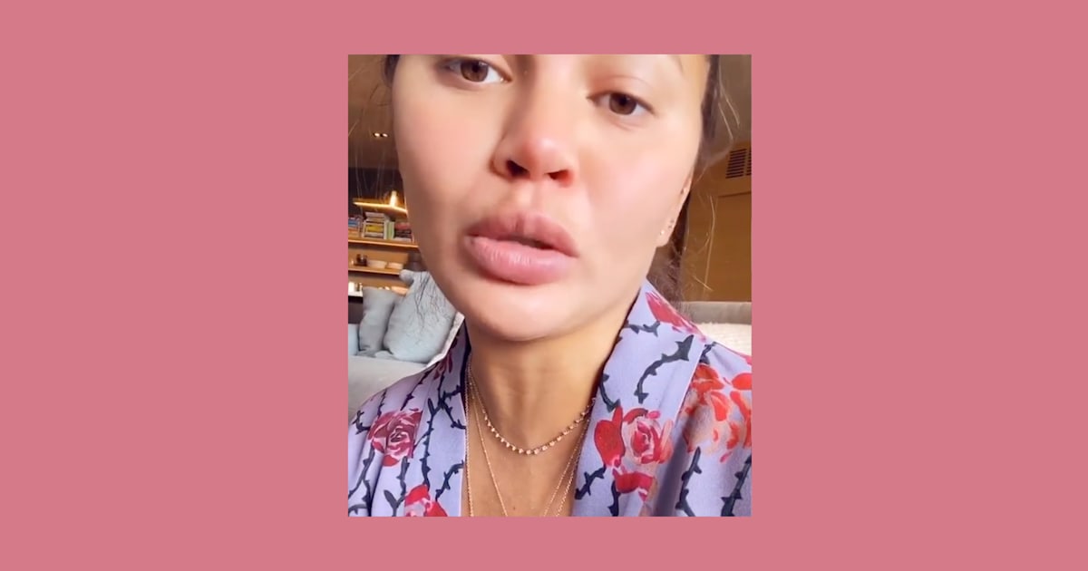 Chrissy Teigen has been eating a lot of sour candy