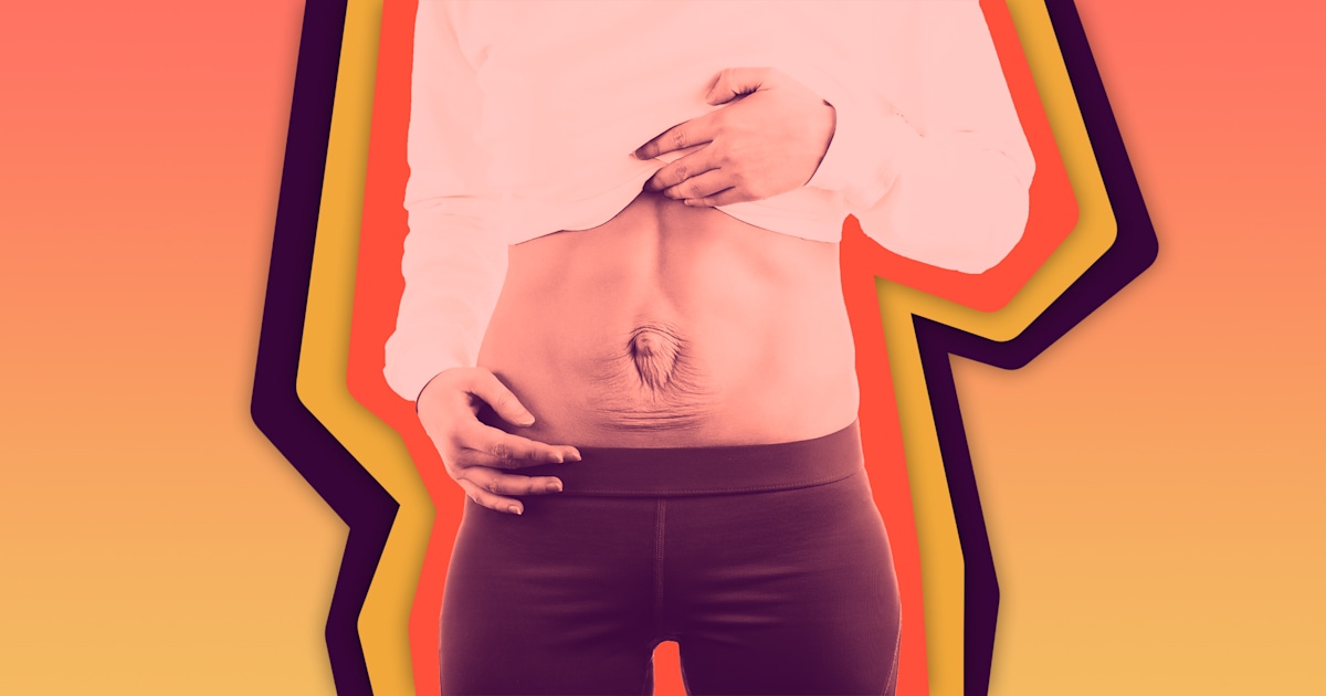 Diastasis Recti or Hernia: is it the same? — Buff Body Fitness