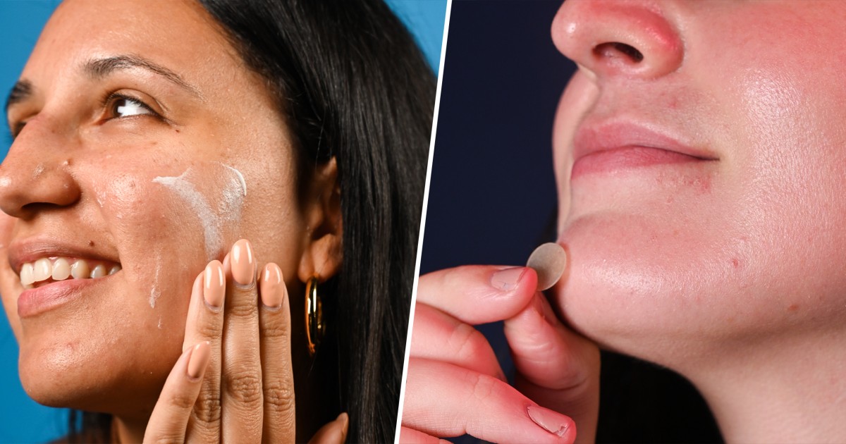 21 best acne spot treatments of 2023, plus expert picks TODAY