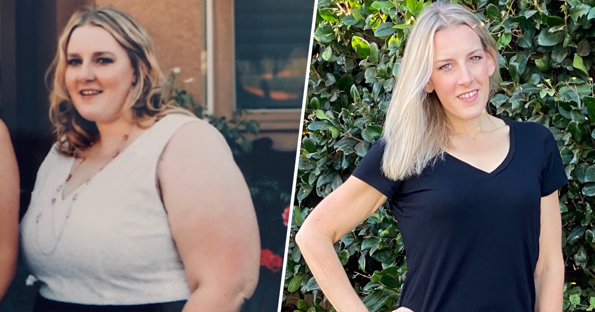 Woman Shares Reality of 150lb Weight Loss With Permanent Deep Stretch Marks