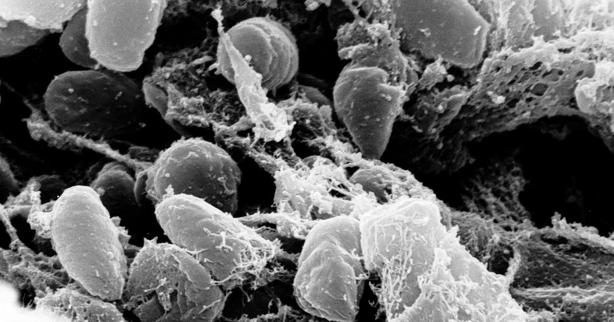 Arizona Patient Dies in Emergency Room From Plague