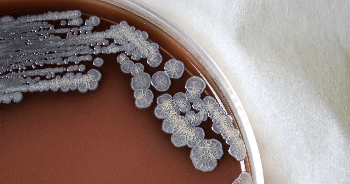 Deadly bacteria found in US soil for first time, CDC says