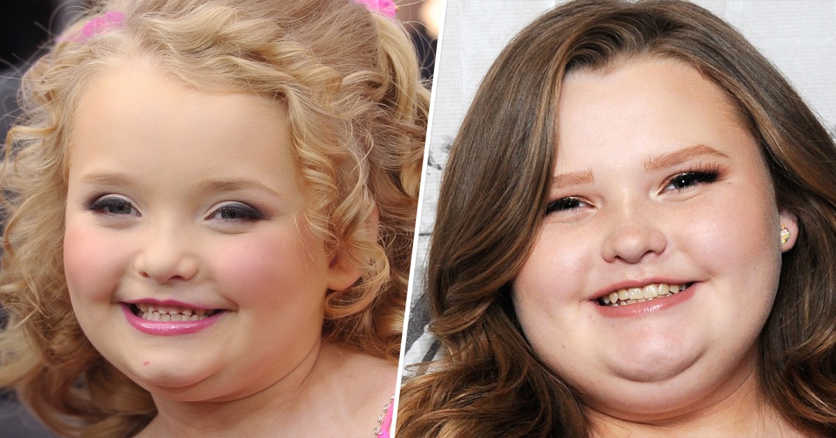 WeightLoss Surgery What Honey Boo Boo, And Everyone, Gets Wrong About It