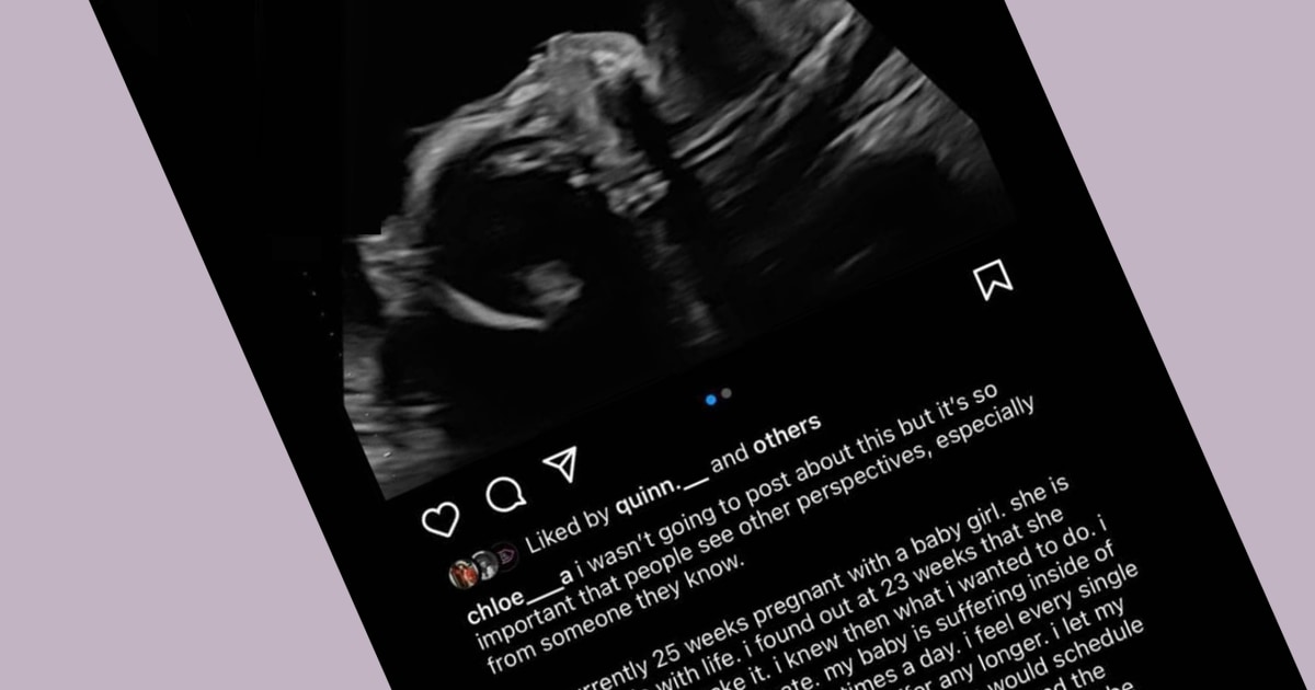 Roe V. Wade Ruling: She Found Out Her Baby Wouldn't Survive, But Was ...