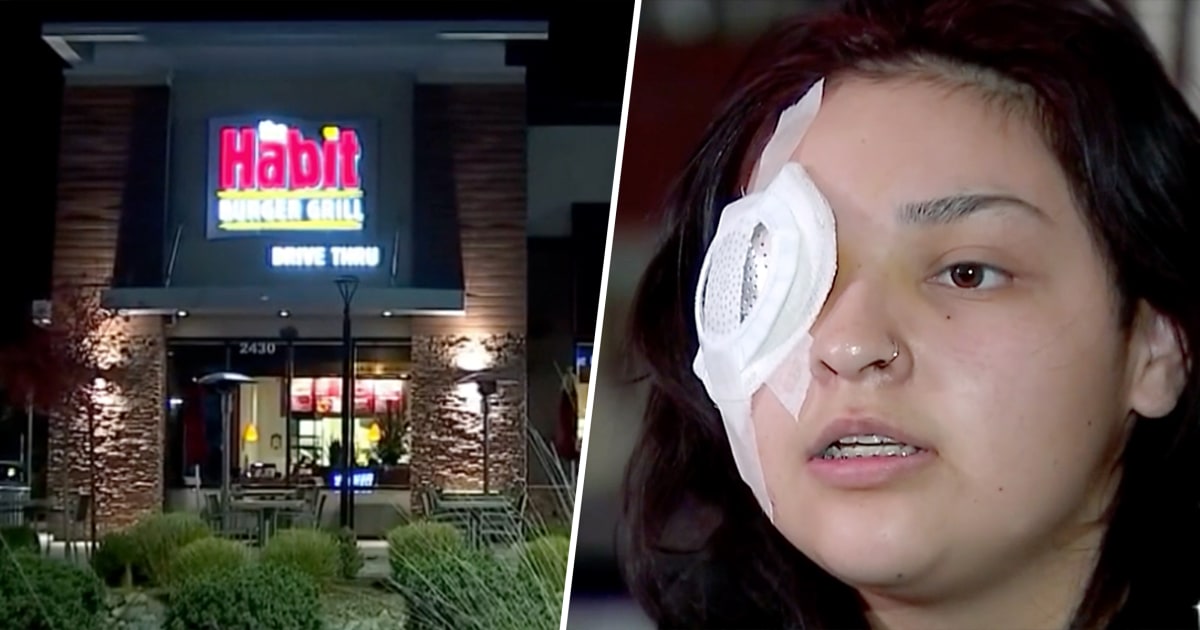 Fast-food worker, 19, loses eye protecting special needs boy from bully