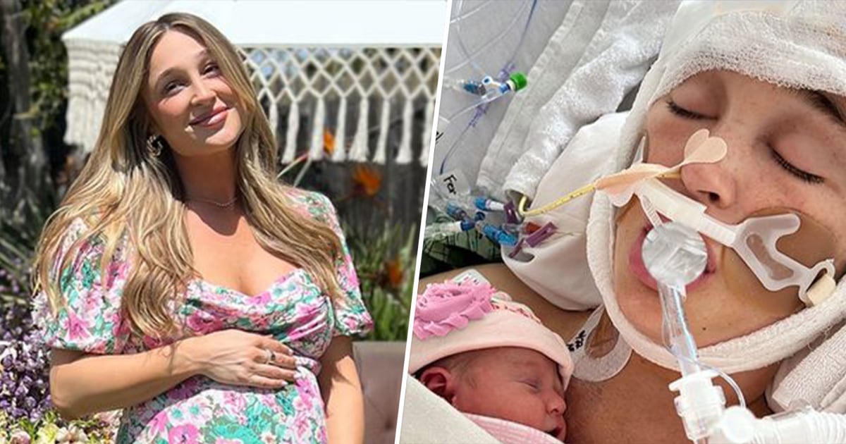 Influencer in coma after brain aneurysm ruptured at 9 months pregnant