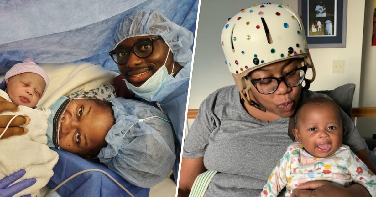 Stroke Mama Warns About 2 Brain Bleed Symptoms After Giving Birth