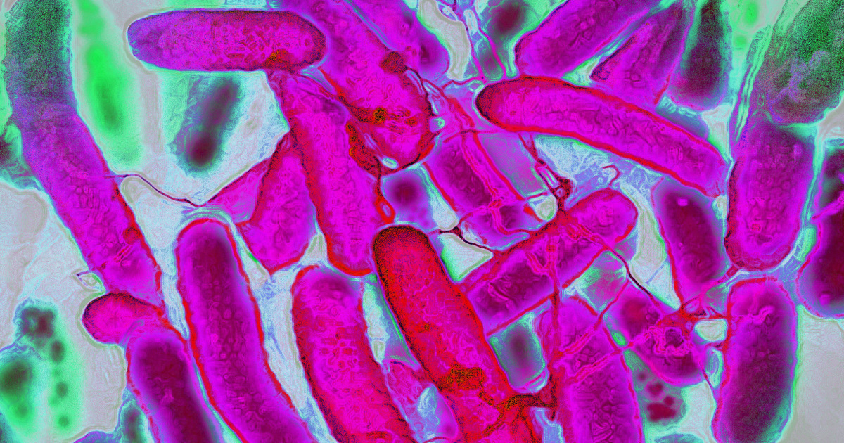 Gut toxin may be a ‘critical piece of the puzzle’ behind the rise in early-onset colorectal cancer