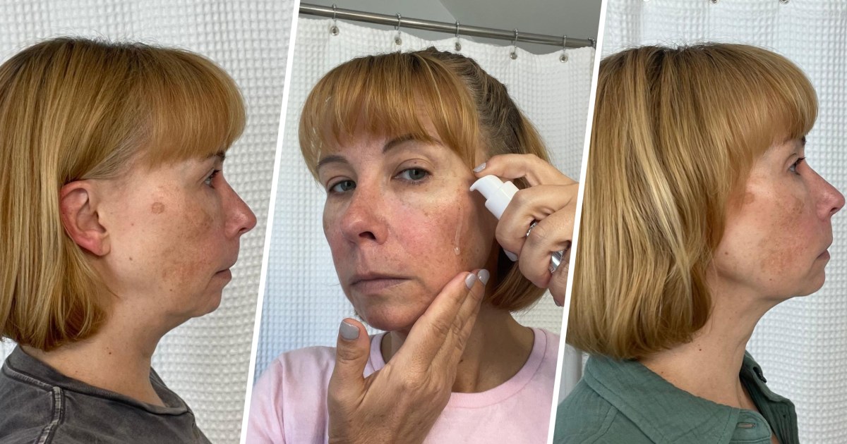I Thought This Jaw-Defining Serum Was Too Good to Be True, Then I Tried It