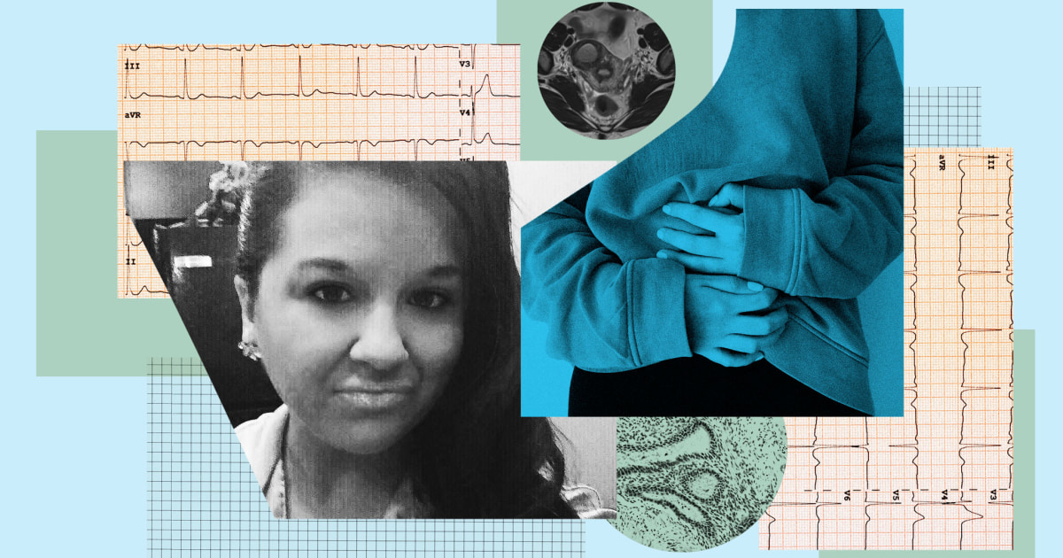 Woman, 37, Recalls the ‘3-Day Nightmare’ That Led to Endometriosis Diagnosis