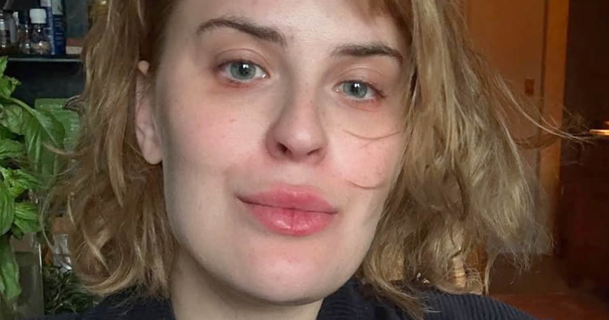 Tallulah Willis Shares Before and After Photos of Her Hair Amidst Eating Disorder Recovery