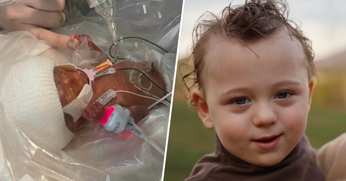 Toddler Born at 22 Weeks Is a 'Miracle' ... And He Has the Perfect Name