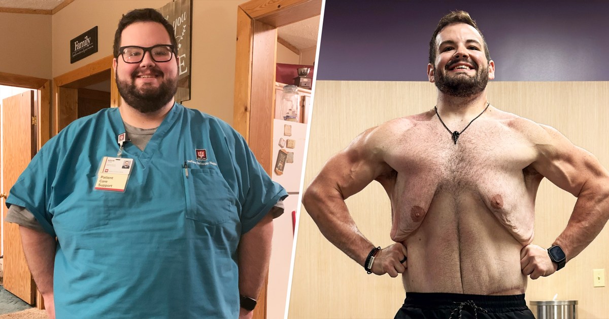 Nurse Loses 270 Pounds With Bariatric Surgery, Diet, Lifting