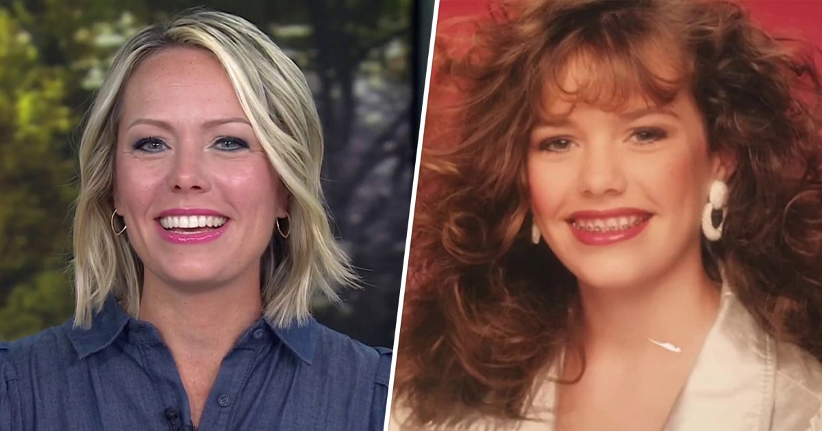 Braces Are Now 'In': TODAY Anchors Have Memories (and Photos) to Share