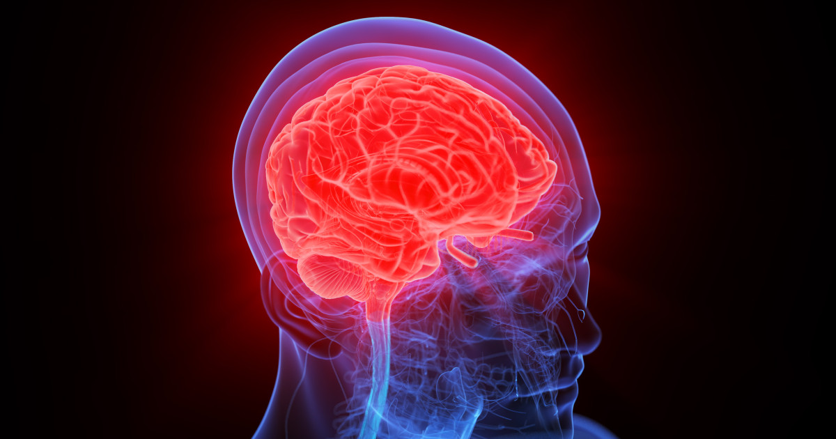 The No. 1 Most Important Alzheimer's Disease Symptom a Doctor Monitors in Herself