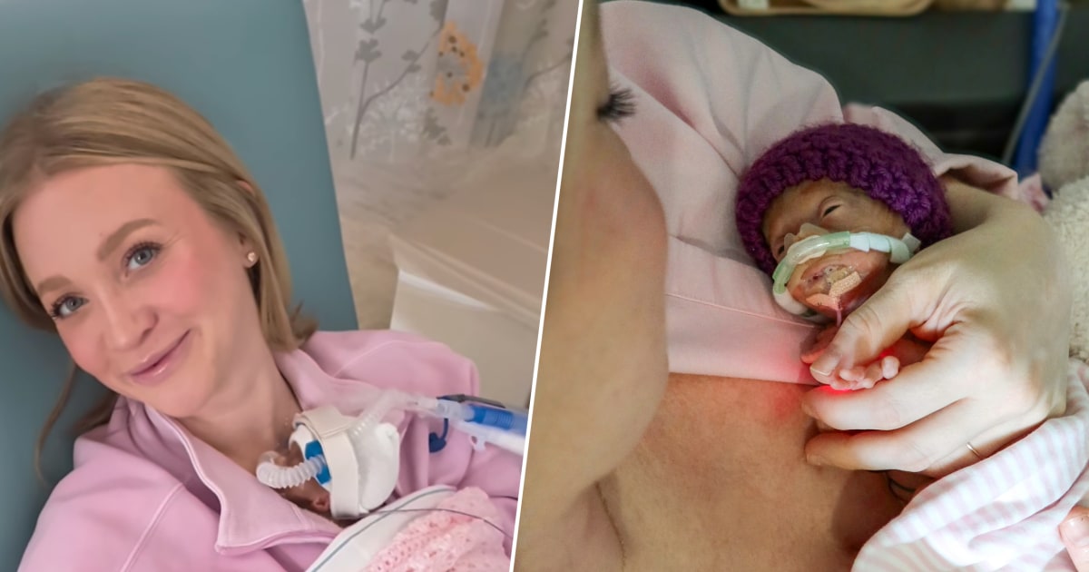 She Was Told Her Tiny Baby Wouldn't Survive. But This Mom Believed: 'That's Not Going to Be Our Story'