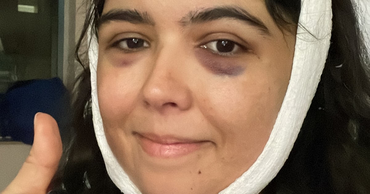 Her symptoms included feeling emotionless after having a baby and experiencing migraines for the first time in her life. “Nobody would have ever imagined” the diagnosis, she says.