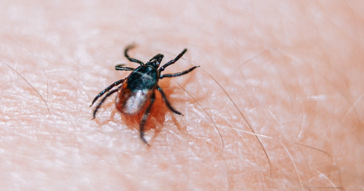 Lyme disease that’s caused by a different species of bacteria from most cases and comes with more severe symptoms than the traditional tickborne infection has shown up in New York.