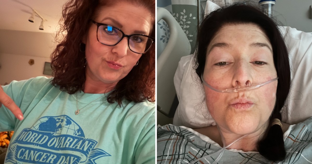 Mom, 47, Diagnosed With Ovarian Cancer Recalls Her Only Symptom: ‘Very Crazy’ - TODAY.com