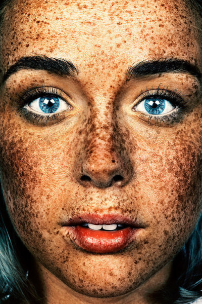 Ebony shared mounth freckles